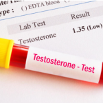 What Is a Normal Testosterone Level?