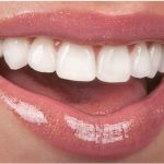 How Lumineers Can Improve Your Smile