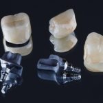 What Is the Average Dental Crown Cost?