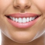 8 Habits to Help You Achieve a Perfect Smile