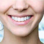 What Are the Advantages of Perfect Straight Teeth?